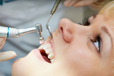 Профессиональная чистка и гигиена всей полости рта, Шведская стоматология